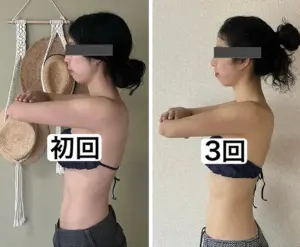 施術ビフォーアフター