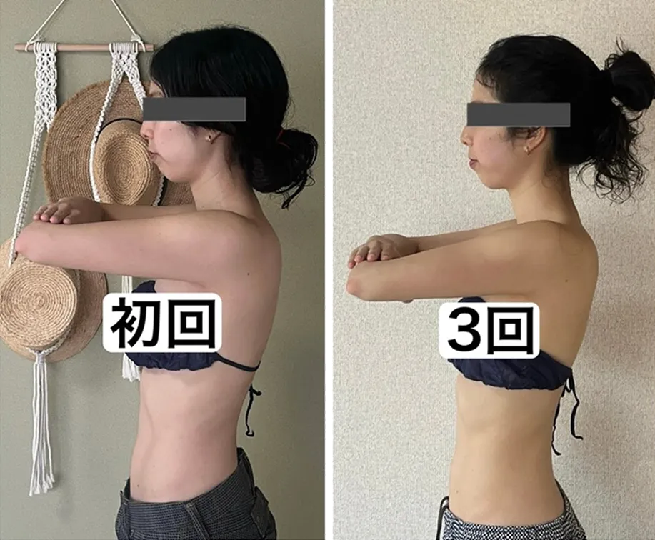 施術ビフォーアフター